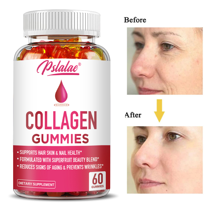 Health Wellness Gummies - Collagen Gummies - for Overall Health